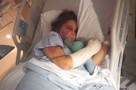 Kirra Harts story — Her brutal attack explained